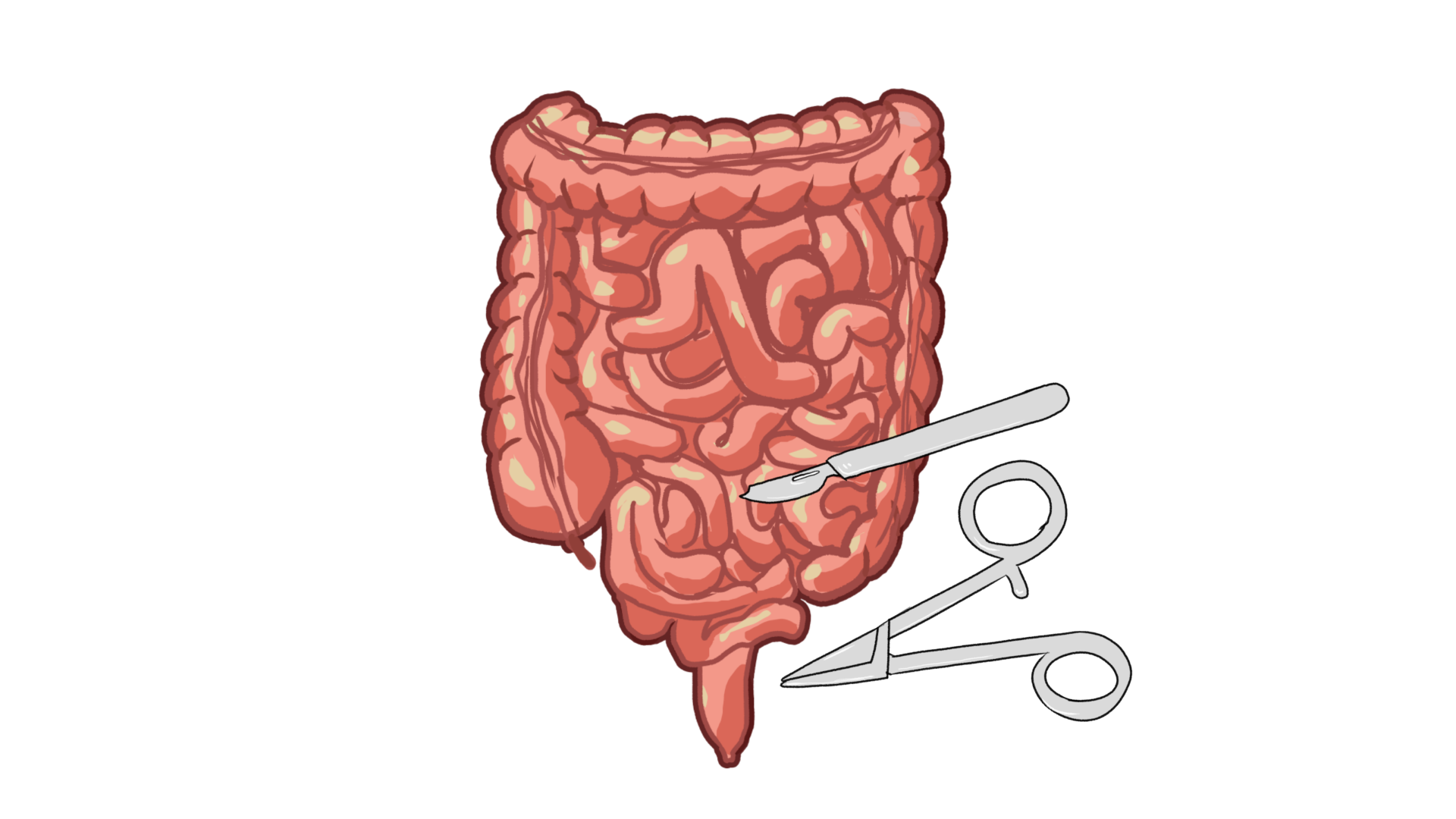 acute-abdomen-drbeen